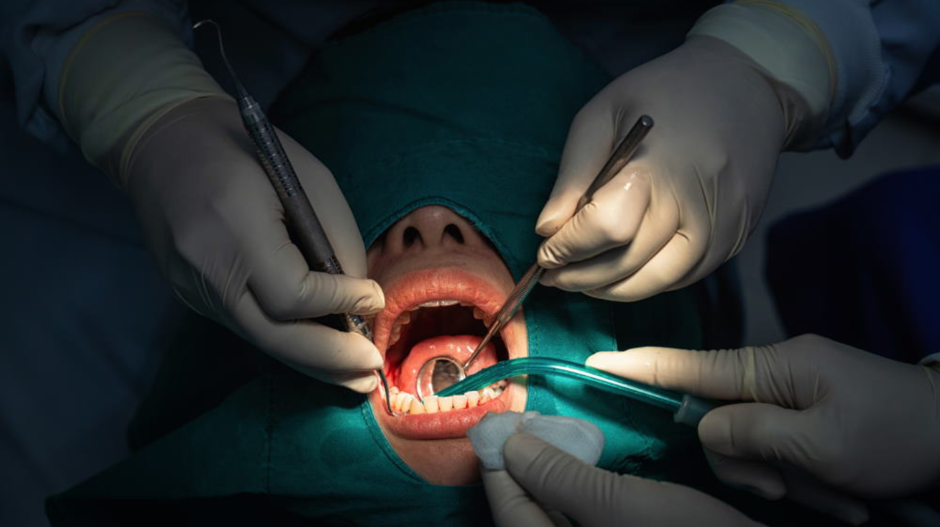  best minor oral &
                                    dental surgical treatments in guntur