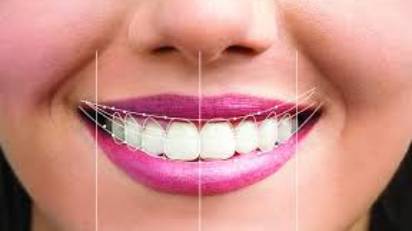 best Smile Design in guntur