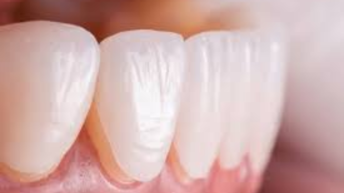 best Dental Ceramics in guntur